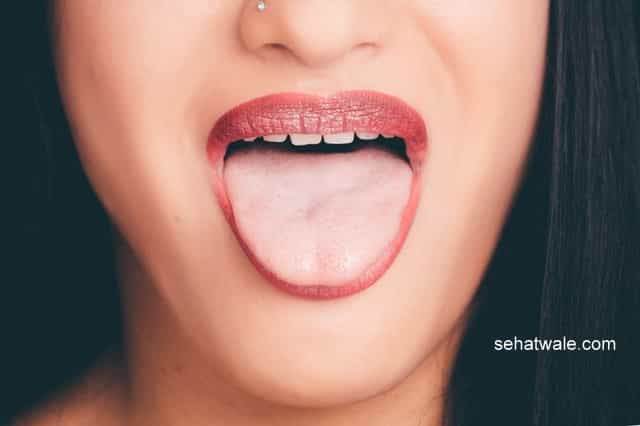 मुंह के छालों ( mouth ulcer ) के 13 कारण ,15 घरेलू उपचार (in Hindi)